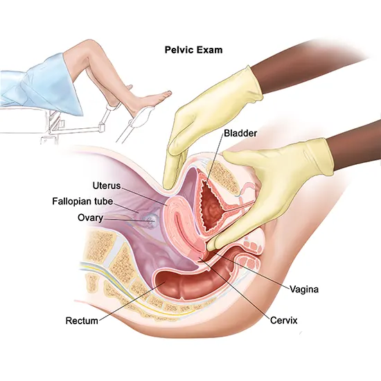gestational trophoblastic tumor
